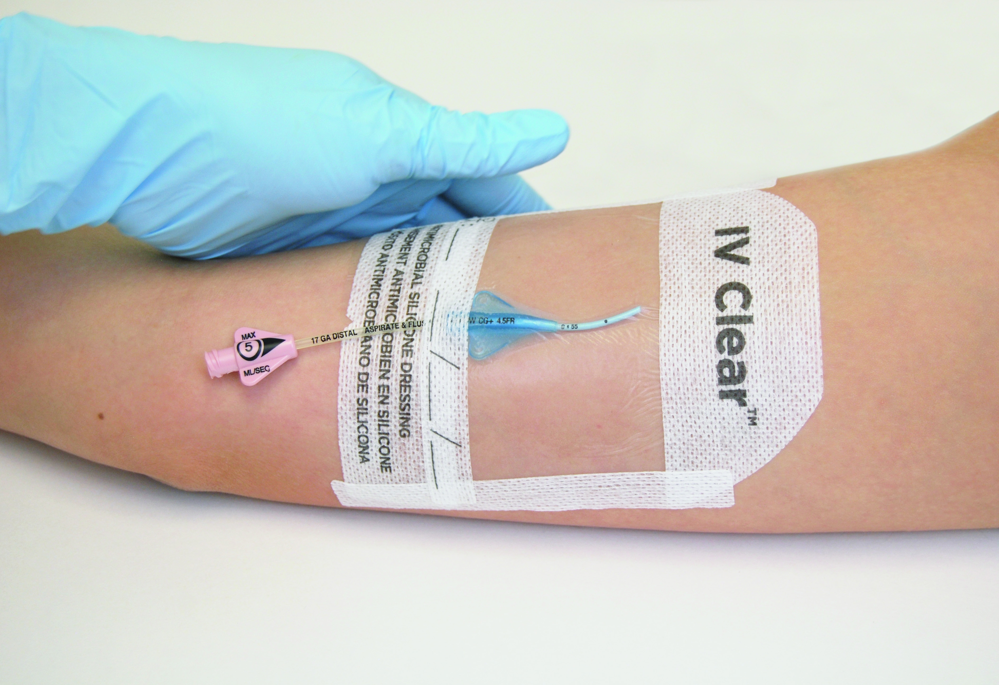 Cateter Semi-Implantável Hickman BD BARD