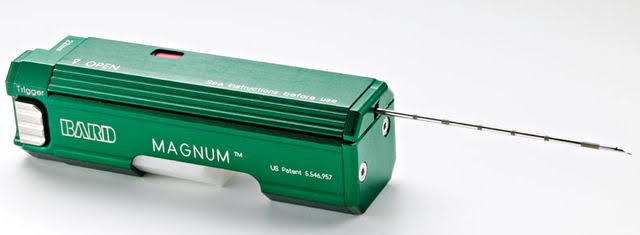 Cateter Semi-Implantável Hickman BD BARD